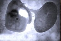 Embryo am 20. Tag